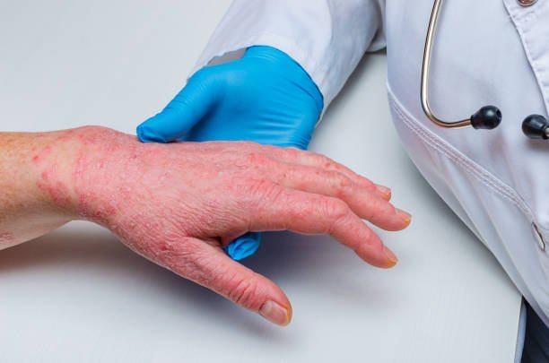Skin Diseases Treatment in Abu Dhabi
