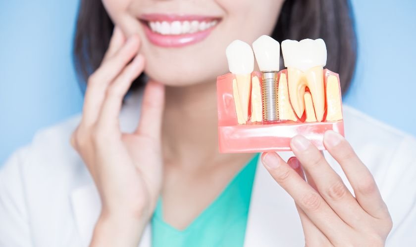 Implant Dentistry: Your Guide to Permanent Smiles