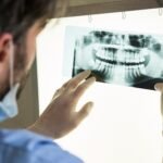 Seeing Inside Your Smile: The Basics of Dental X-Rays