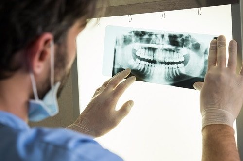 Seeing Inside Your Smile: The Basics of Dental X-Rays