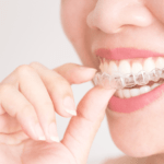 Straighten Your Smile with Invisalign Retainers
