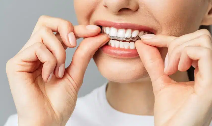 invisalign orlando