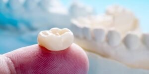 Same Day Crowns – Restore Your Smile in One Appointment