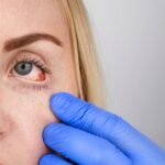 What are the major Glaucoma Treatment Options?