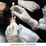 Regain Your Confidence with Hair Transplant Solutions Riyadh