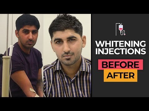 Top Whitening Injections and Laser Hair Removal Treatment in Karachi