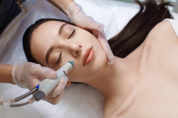 Skin Looks Worse After Hydrafacial