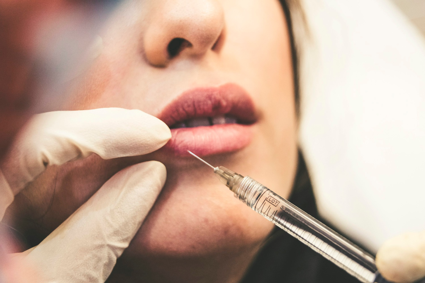 A person getting a lip filler treatment