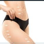 Your Ultimate Resource for Buttock Augmentation in Dubai