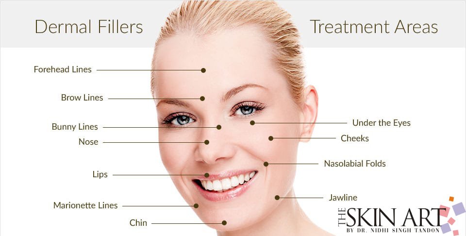 Dermal Filler Treatment in Lucknow