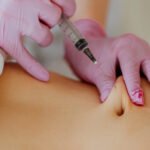 The Safety of Fat-Dissolving Needles in Dubai’s Cosmetic Industry