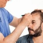 Hair Transplant Cost in Riyadh Pricing: A Comprehensive Guide