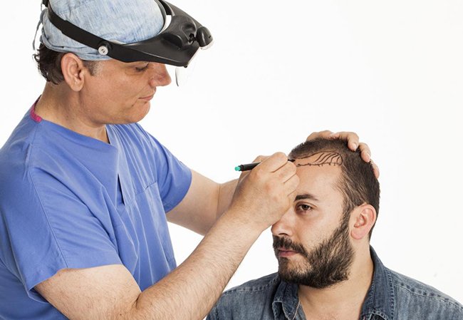 تكلفة زراعة الشعر في دبي