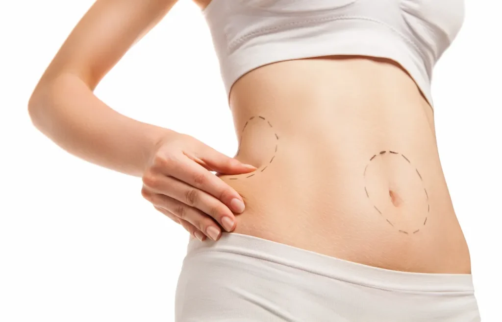 Lipoabdominoplasty in Riyadh