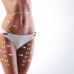 Benefits of Liposuction Surgery in Dubai: A Comprehensive Guide to Body Contouring