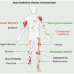 Pain O Soma 500 mg: Effective Relief for Acute Muscle Discomfort