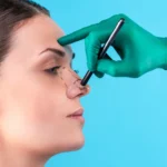 Rhinoplasty in Dubai: Financing Options to Make Your Dream a Reality