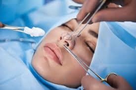 Rhinoplasty in Dubai