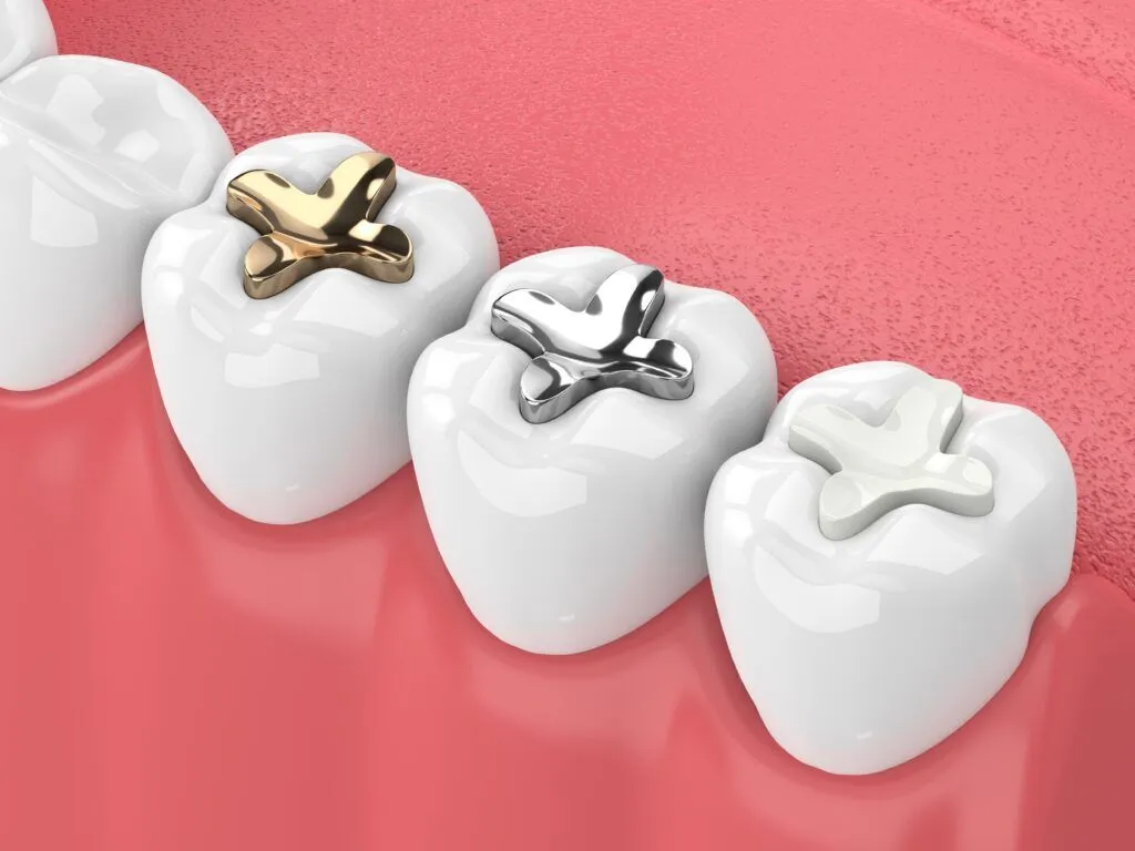 dental filling