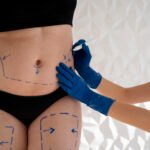 Common Questions About Body Contouring Surgery Answered by Best Doctors in Dubai