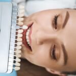 Transform Your Smile with a Veneers Specialist in La Mirada: Everything You Need to Know