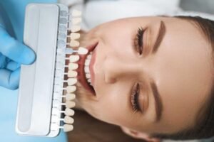 veneers specialist la mirada