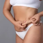 Can You Get a Tummy Tuck and Liposuction at the Same Time?