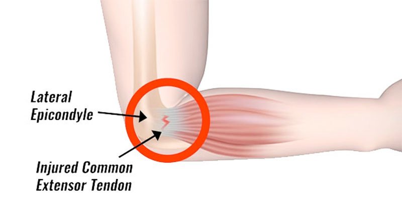 Coccyx Pain Joint Pain Cervical Pain Pain Clinic Shoulder Pain