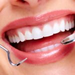 The Best Teeth Whitening Options: What You Need to Know