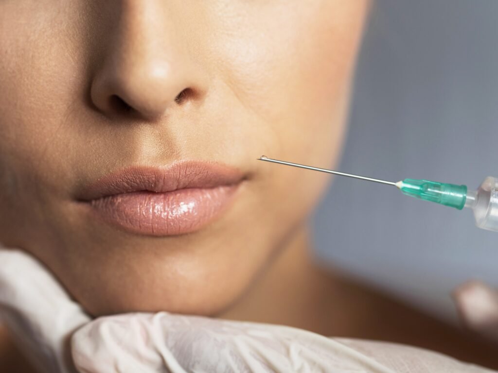 Best Lip Fillers Injections in Dubai