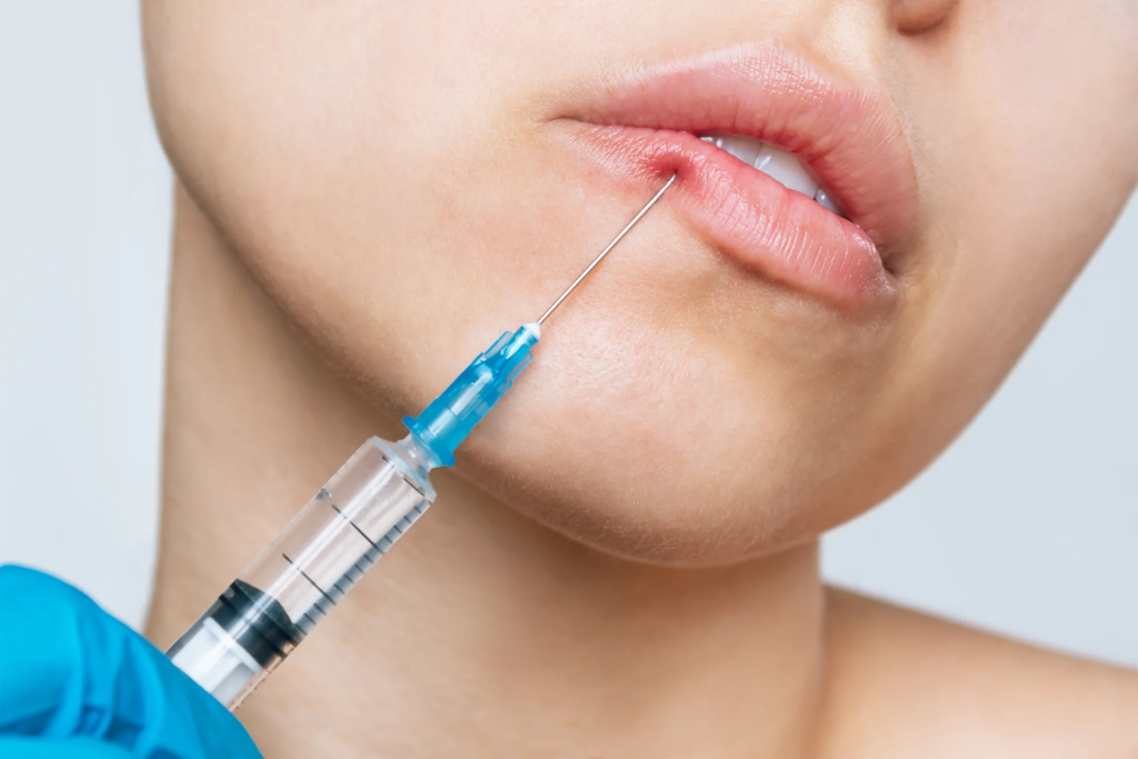 Best Lip Fillers Injections in Dubai