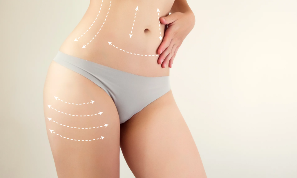 Best Liposuction Surgery Cost in Dubai