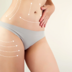 The Best Full Body Liposuction Surgeons in Dubai An Overview of Their Techniques