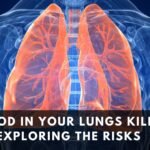 Can Food in Your Lungs Really Kill You? Exploring the Risks and What to Do Next