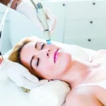 Hydrafacial Treatment in Dubai: Best Options for Sensitive Skin