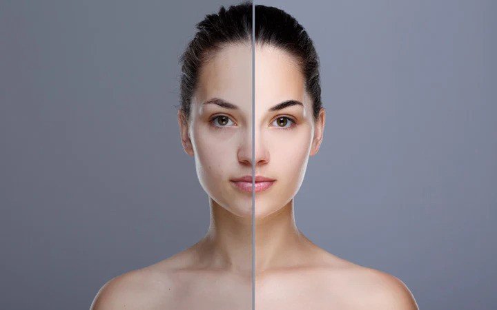 Is Triple Mix Skin Treatment Right for You? Discover the Benefits!