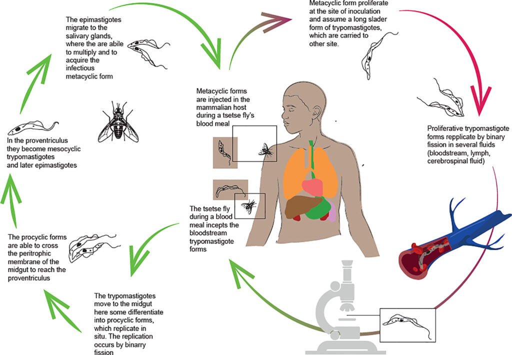 Trypanosomiasis