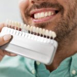 Your Guide to Teeth Bleaching: Everything You Need to Know from a La Mirada Dentist