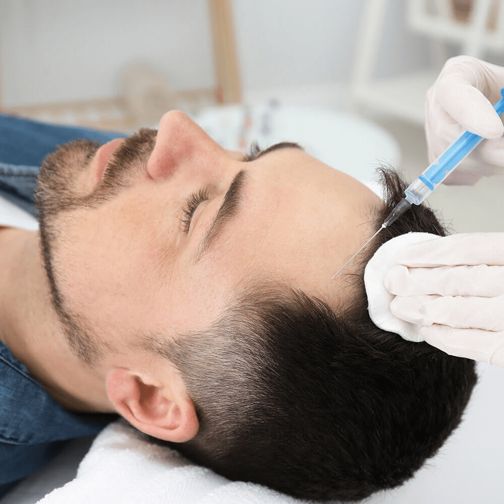 Hair Loss Treatment in Dubai