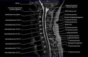 CT Head and Neck Sagittal Labeling