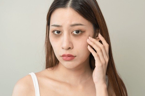 Can HIFU Technology Help Treat Dark Circles