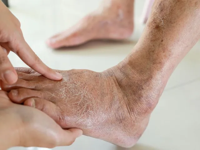 Diabetic Foot Care at Home in Riyadh