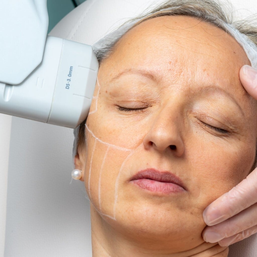 Is HIFU Safe for Skin Tightening Around the Eyes and Neck