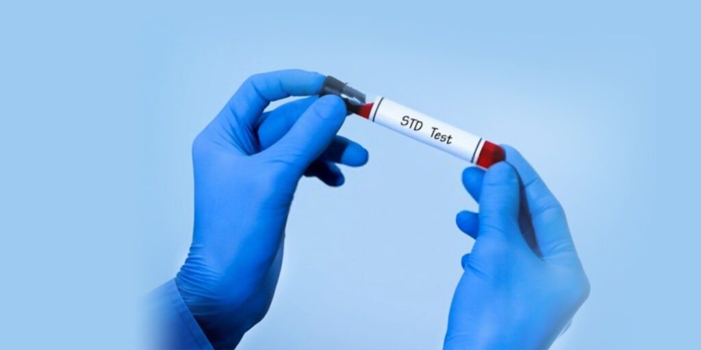 How Are STDs Diagnosed Before Treatment In Dubai | UAE?