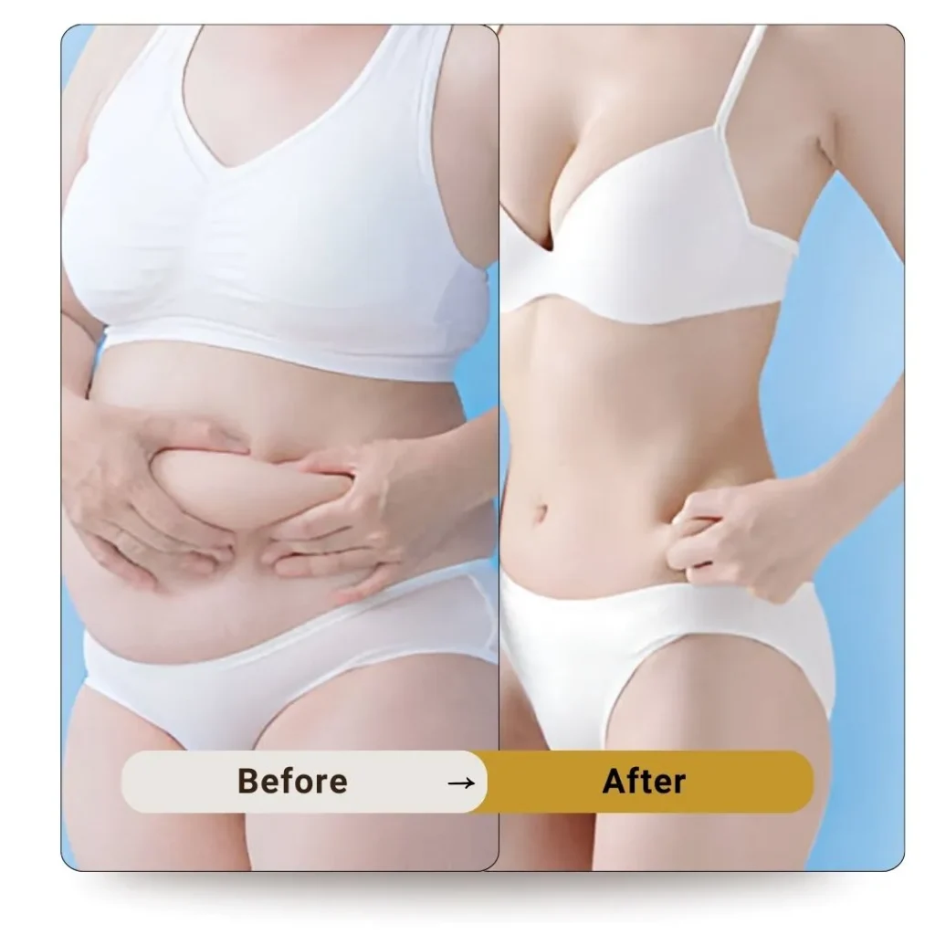 Mounjaro Injections in Dubai