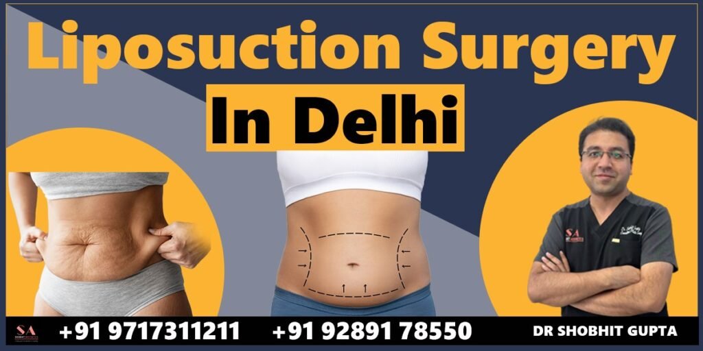 Liposuction Surgery in Delhi