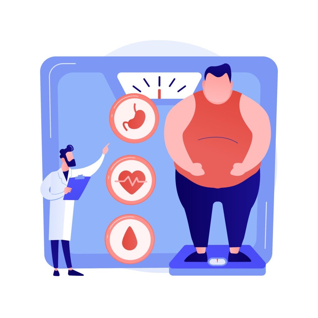 Weight loss surgery