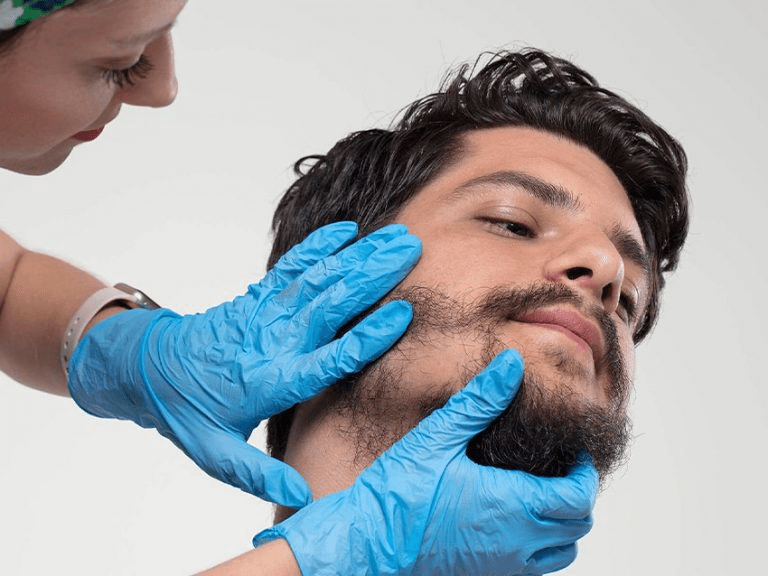 Beard Hair Transplant in Riyadh