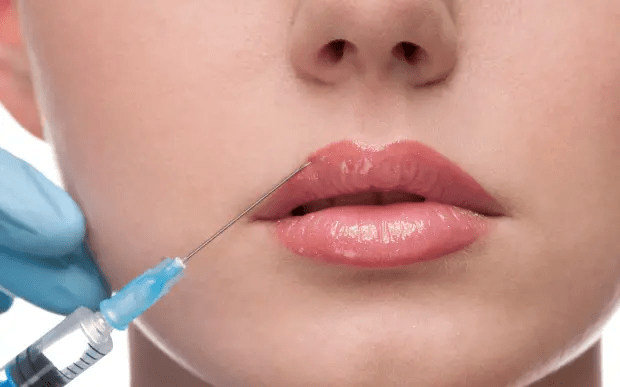 Botox Injections Lip Flipping: How to Prepare for Treatment