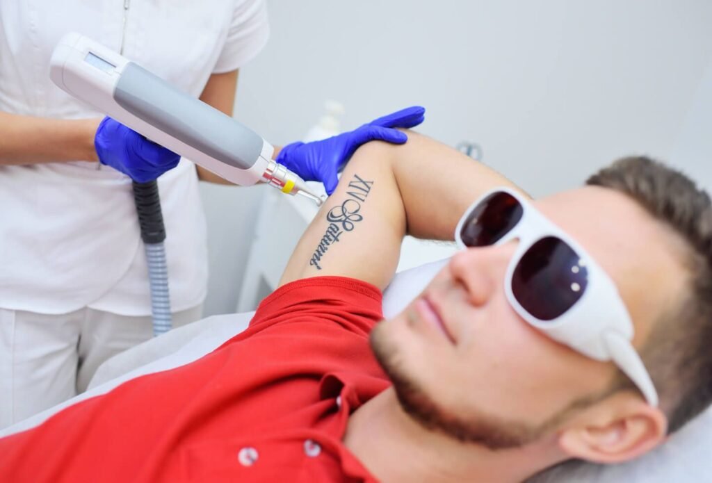 Laser Tattoo Removal in Dubai